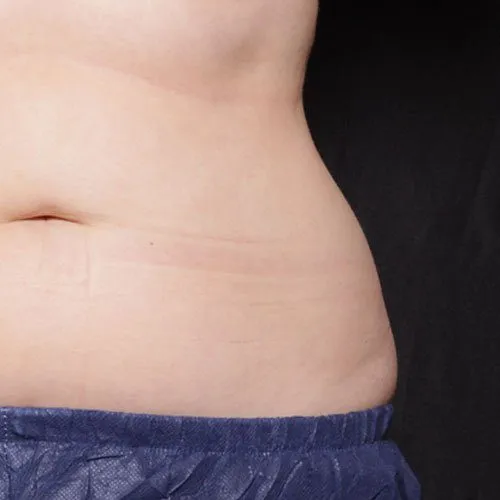 Before and after images