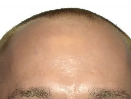 Before and after images