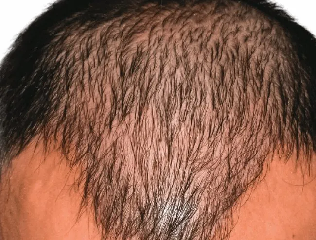 Before and after images