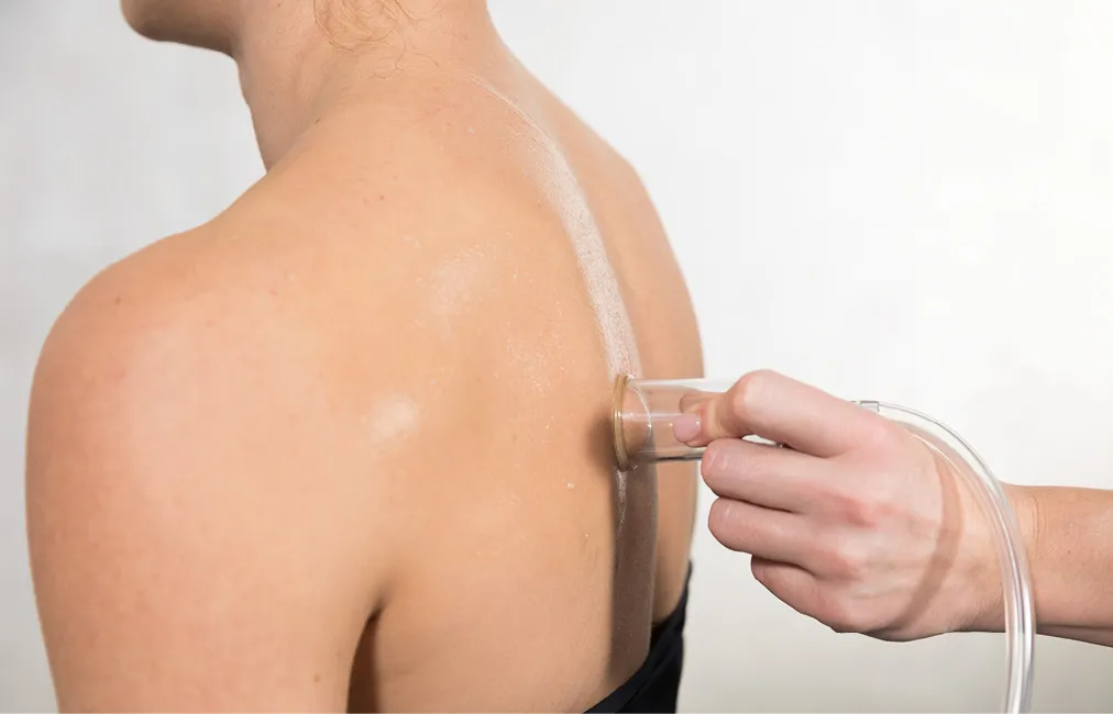 Suction-style therapy applicator being used on a patient's shoulder blade
