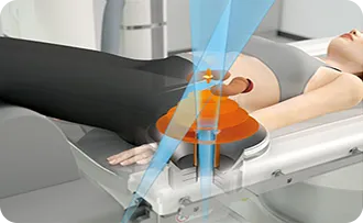 Illustration of a lithotripsy imaging beam targeting a kidney stone inside a patient, table view