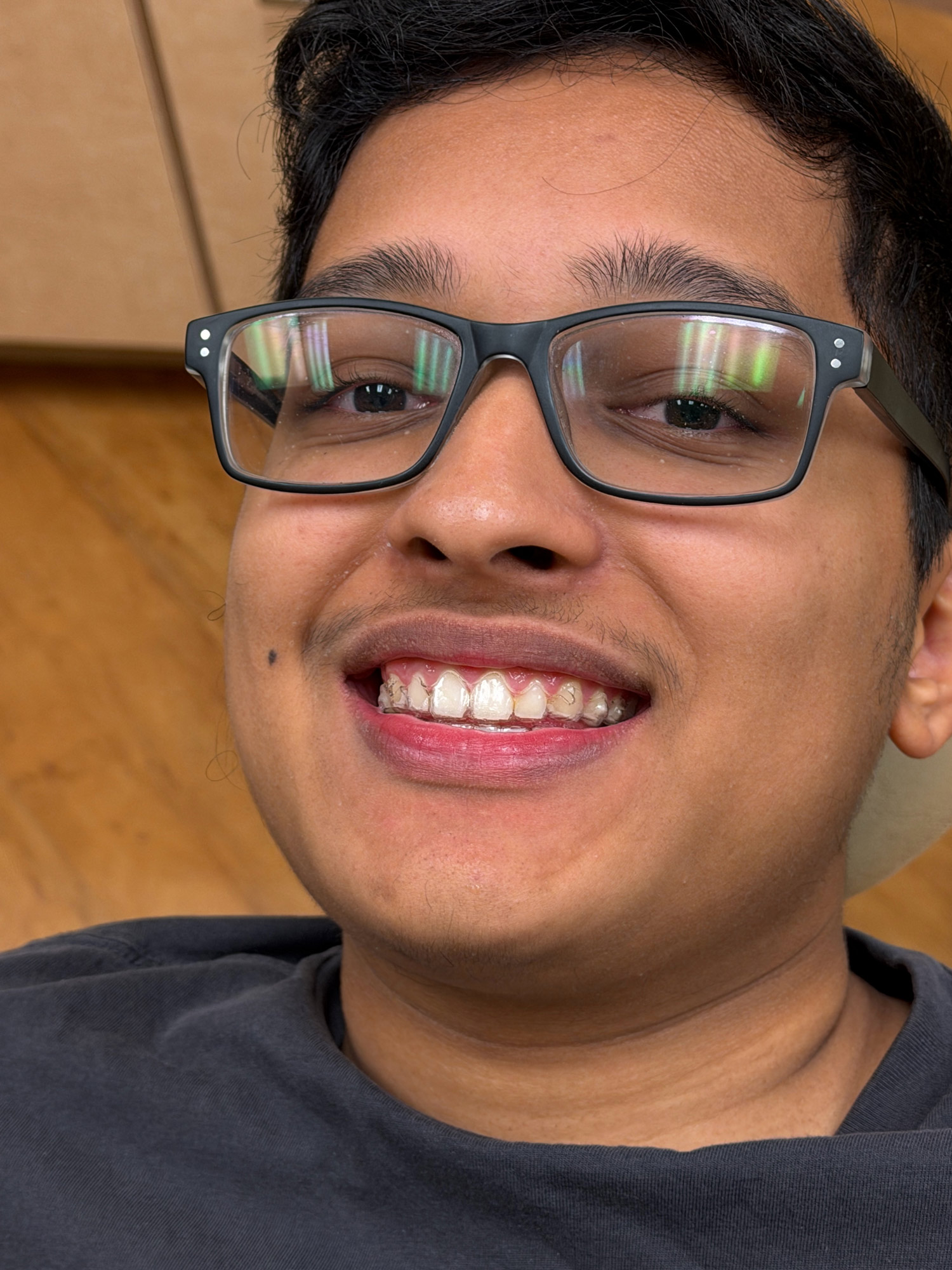 Teenage patient wearing Invisalign Teen clear aligners at Ogden Orthodontics