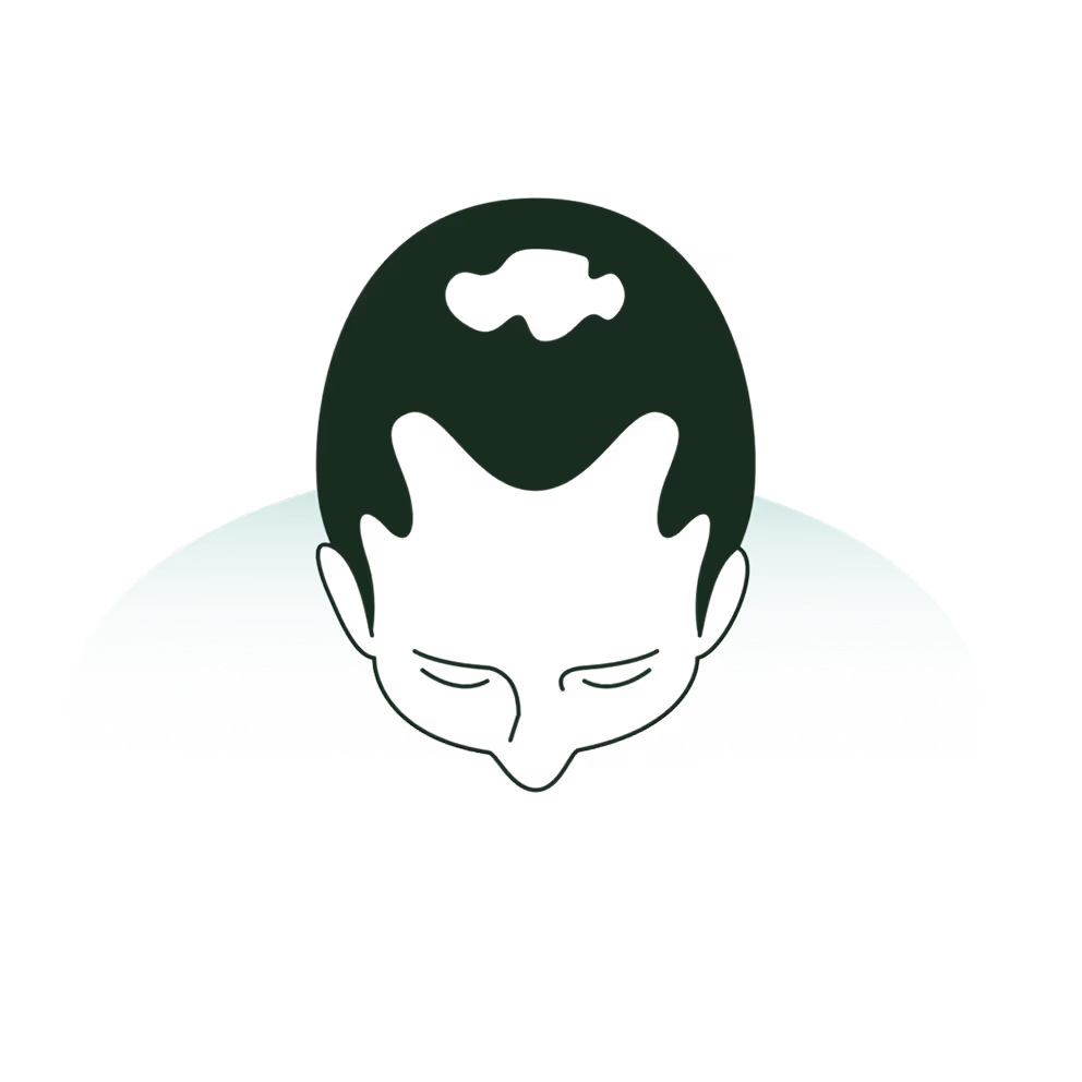 Thinning and receding