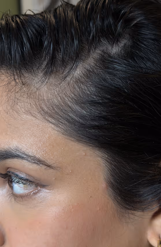 Megha