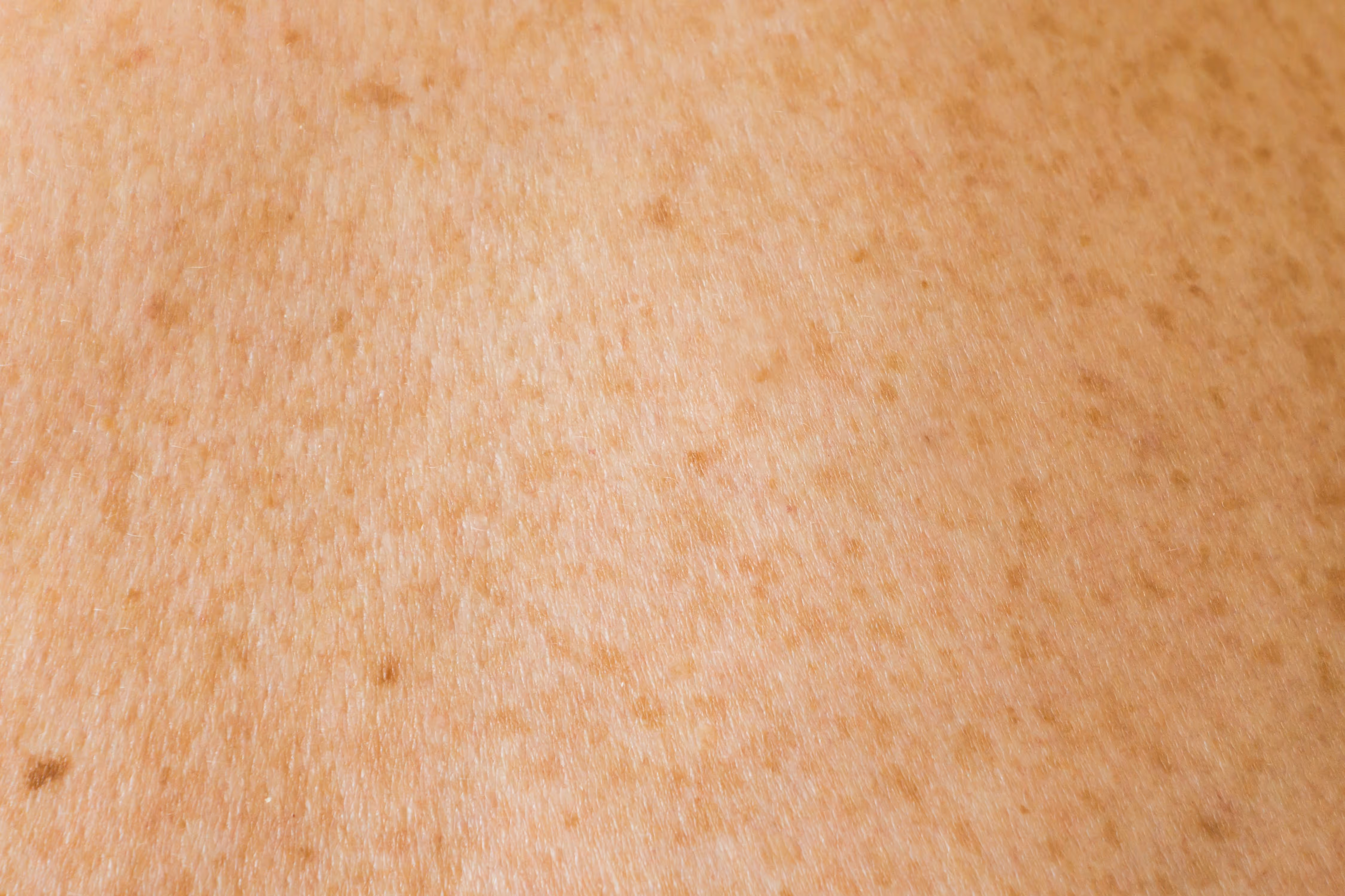 Close-up of skin with light brown freckles scattered across a peach-toned complexion.