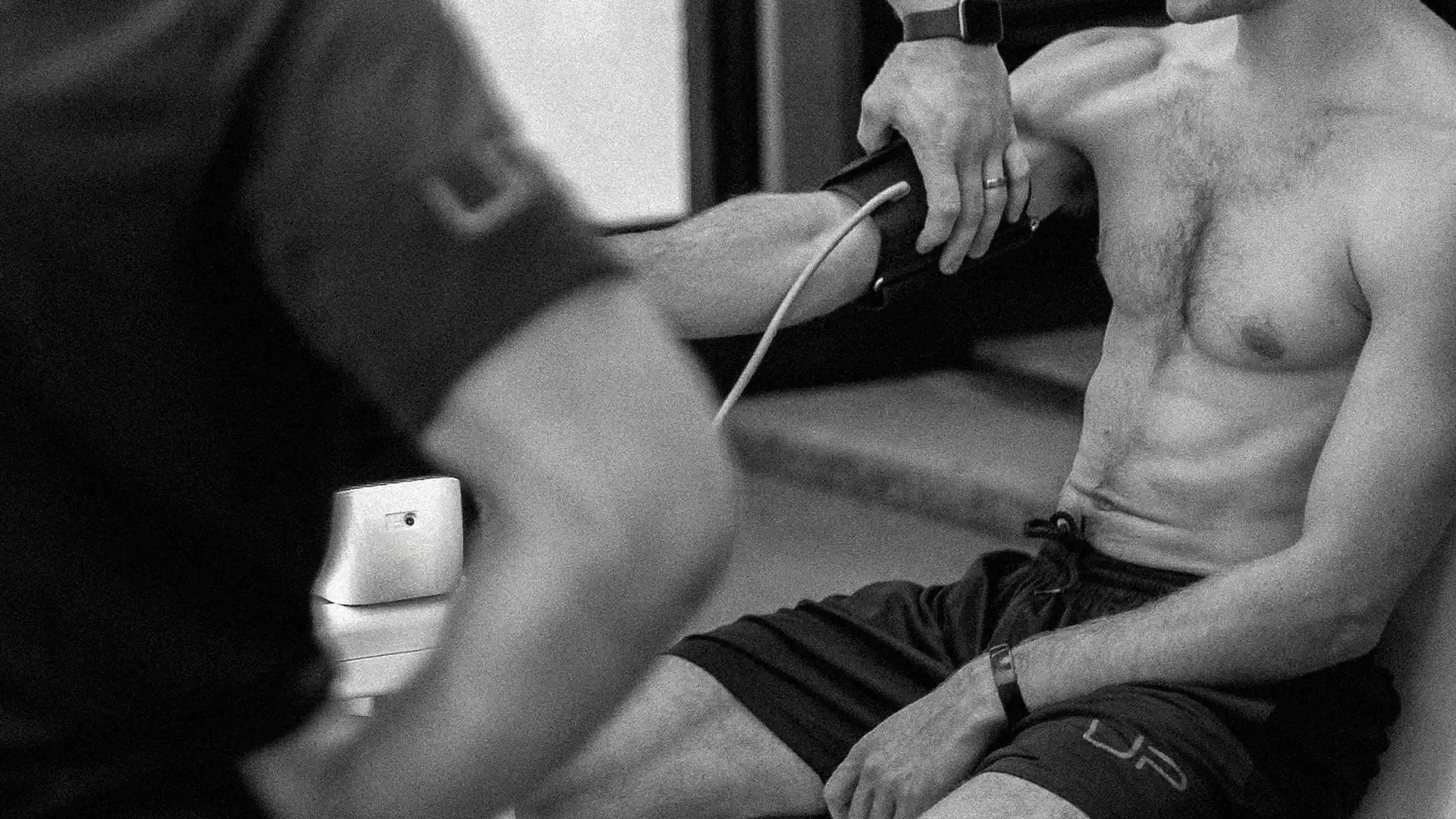 A man wearing black shorts has his blood pressure measured with a cuff on his bare arm by another person.