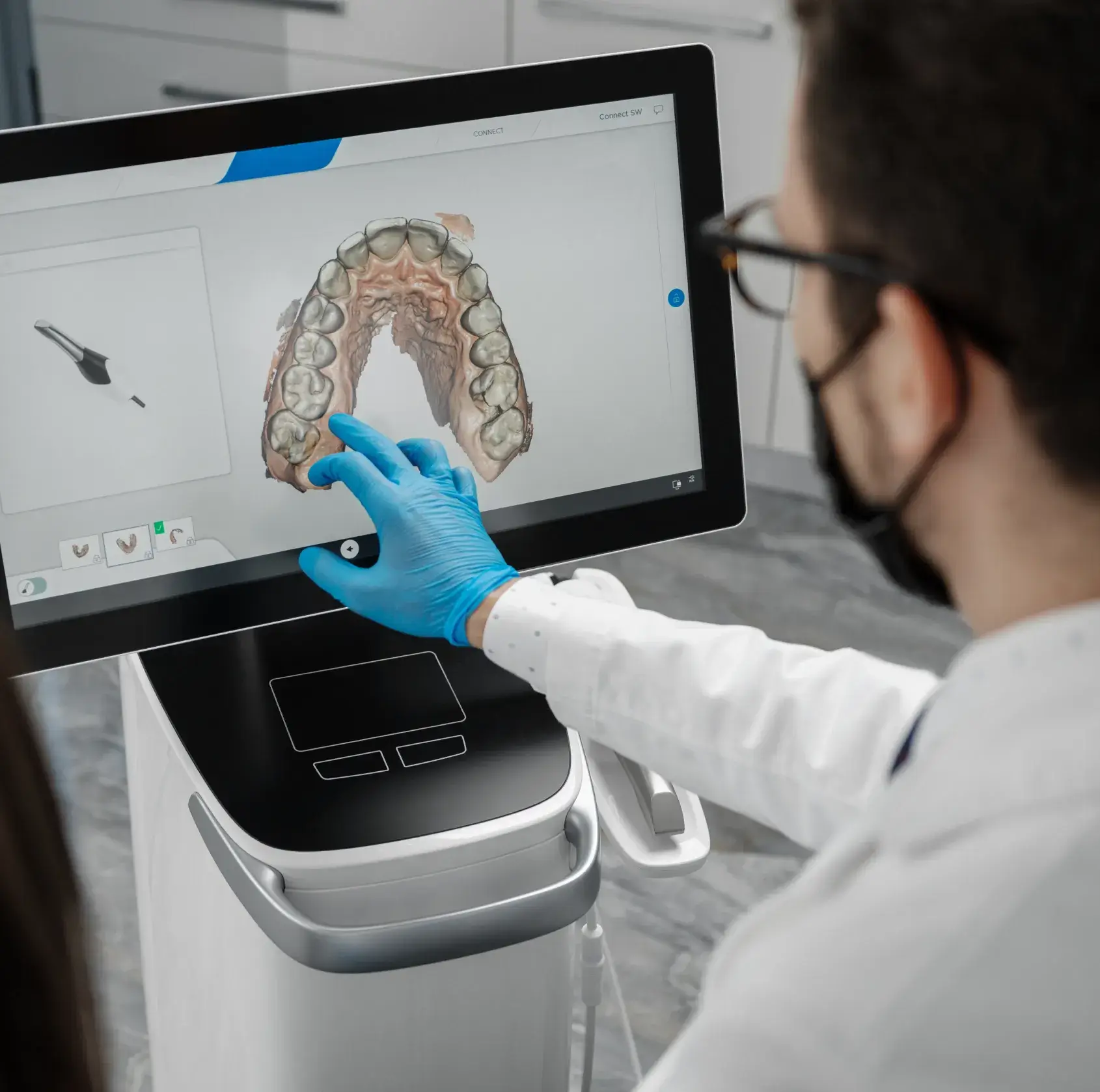 Dentist wearing blue gloves pointing at a digital 3D model of upper teeth on a touchscreen monitor.