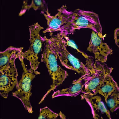 Fluorescent microscopic image of cells with blue nuclei, purple cytoskeletal fibers, and yellow-green cytoplasm.