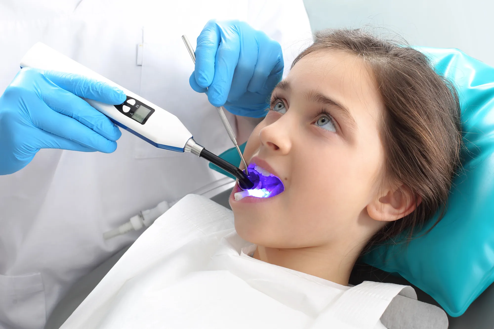 Young girl receiving dental treatment with a curing light and dental mirror inside her mouth.