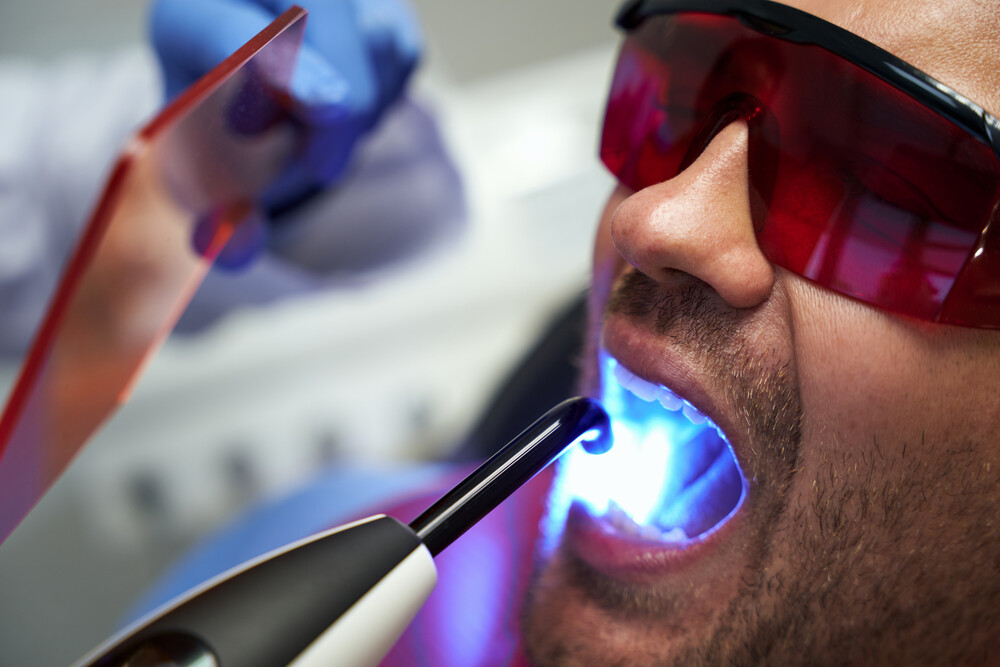 Laser Dentistry: A Revolution in Dental Care