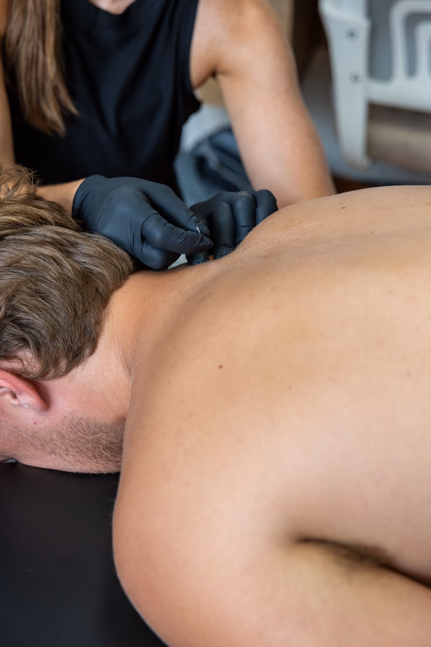 Physical therapist wearing black gloves inserting dry needling needles in a man's neck while he lies face down.