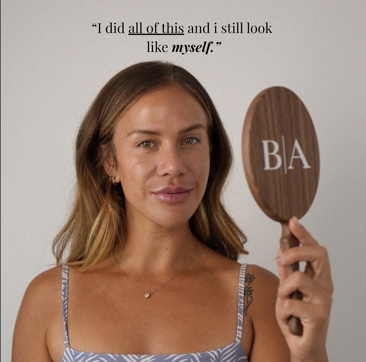 Patient holding a Bonita Aesthetics mirror after natural-looking treatment