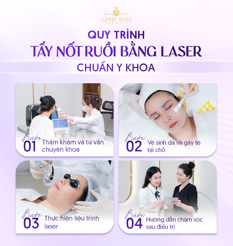 Cách tẩy nốt ruồi bằng laser