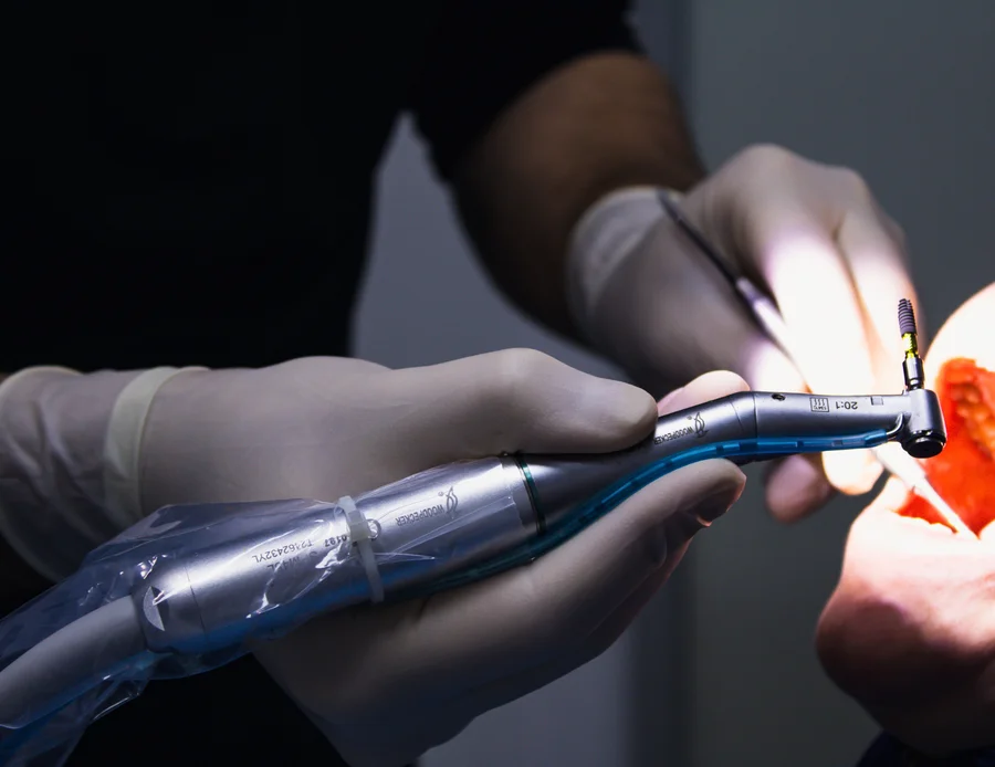 dentist-placing-dental-implant-implants-farmington-hills