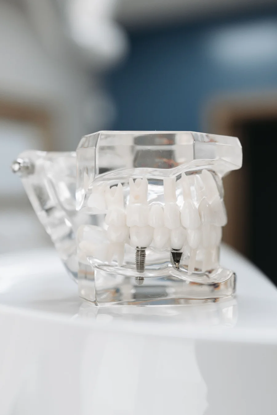 clear-jaw-model-dental-implants-implants-livonia