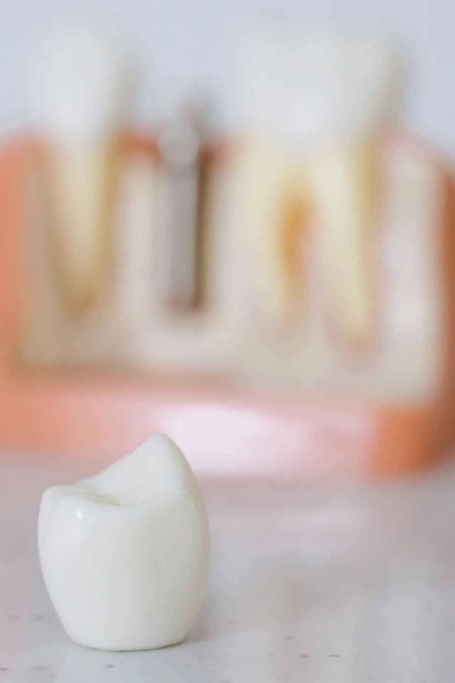 closeup-dental-crown-implant-model-implants-livonia