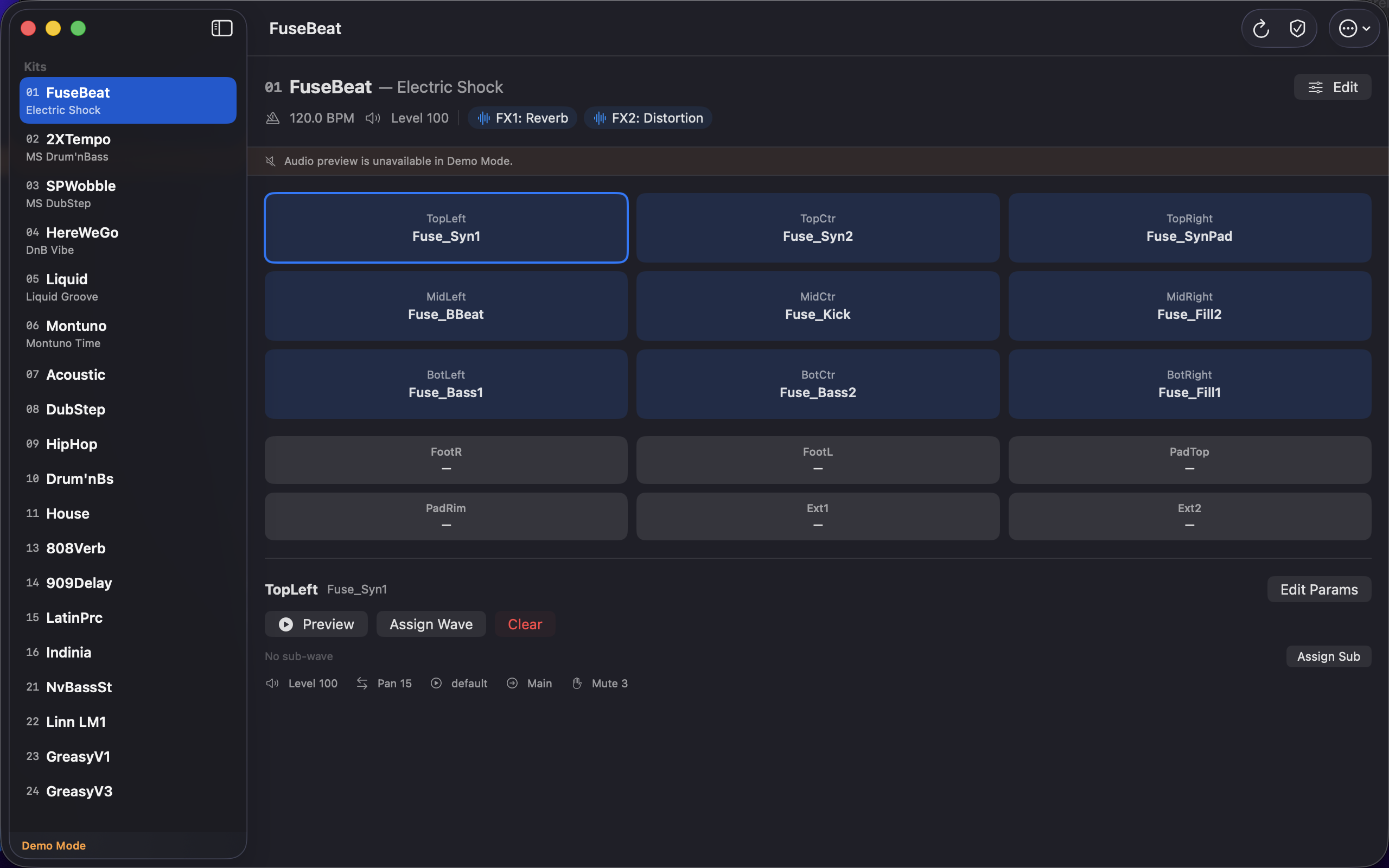 SPD-SX Manager kit detail view