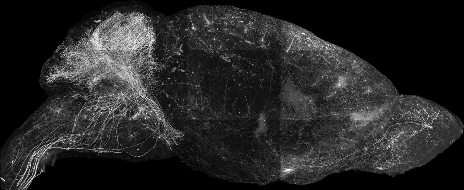 Greyscale image of a sagittal view of a whole mouse brain.
