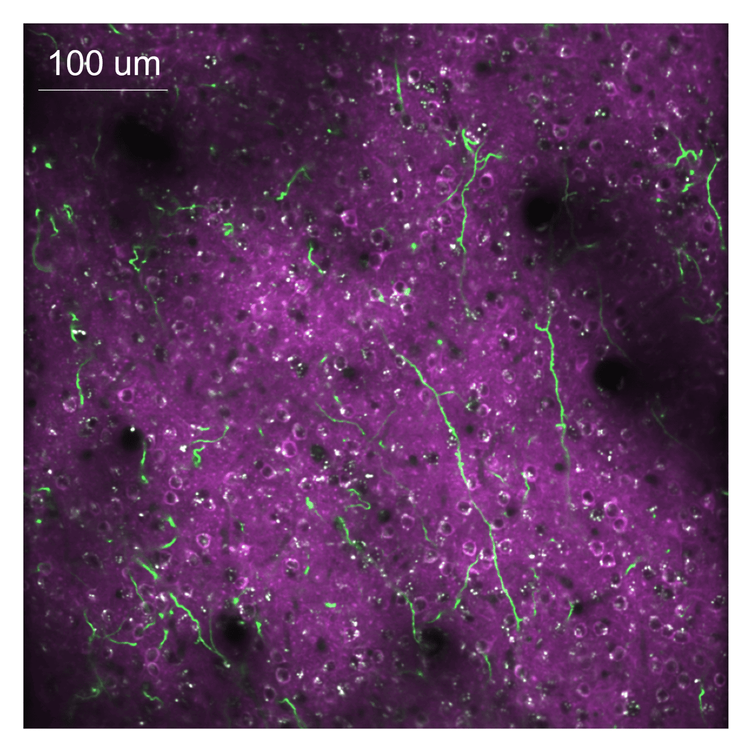 Dual-color image showing jRGECO1a expression in purple within neurons of the motor cortex and GCaMP8s expression as neon green lines in axons from the Locus Coeruleus.