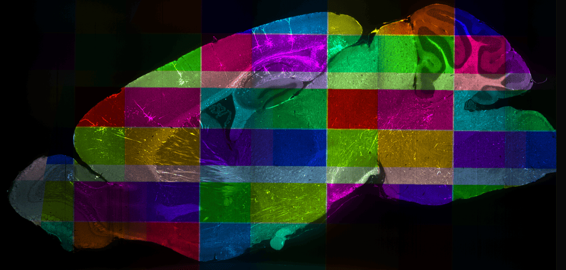 One Dimentional image of the brain with a patchwork overlay of bright and dark rectangular regions.