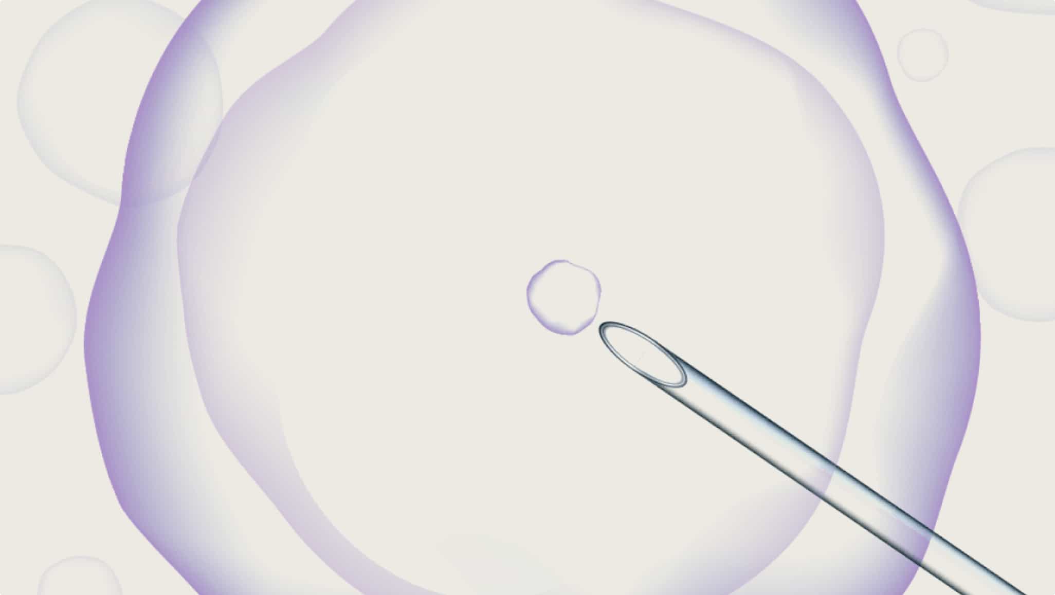 microscope-assisted conception