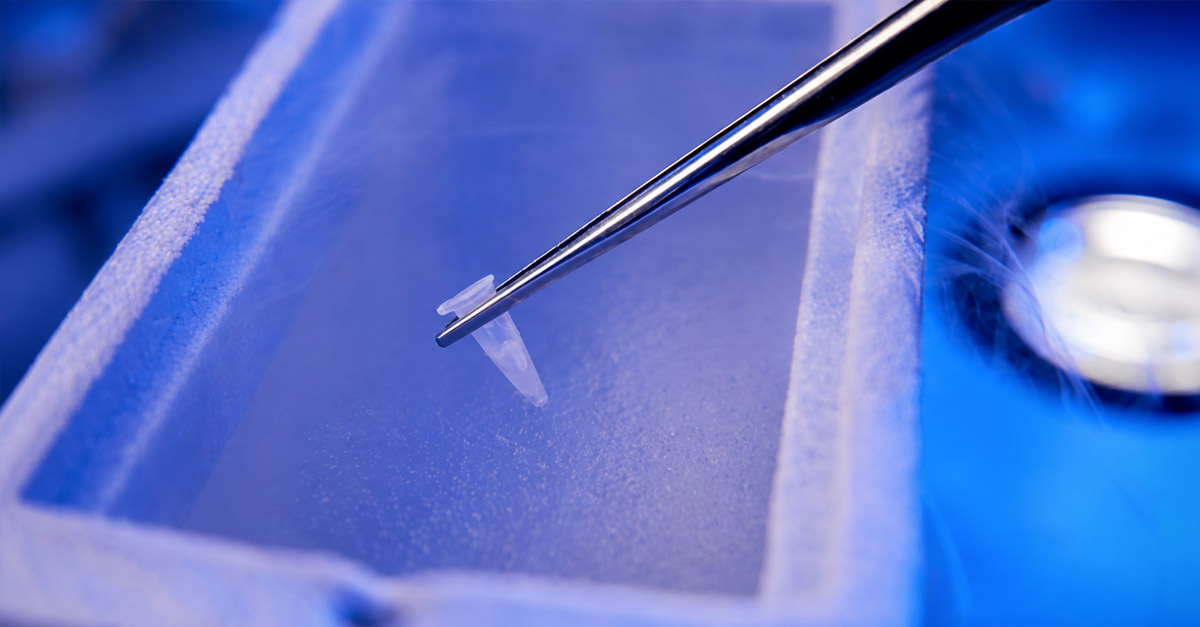 Step-by-step IVF monitoring process for PCOS patients