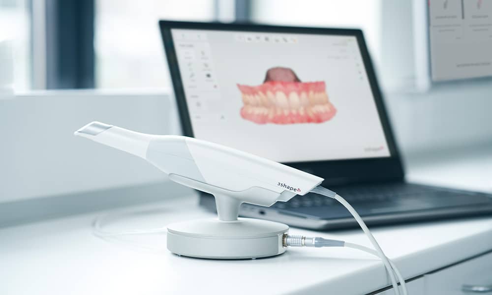 Dental Bonding - Cosmetic Dentist in Redmond, Oregon