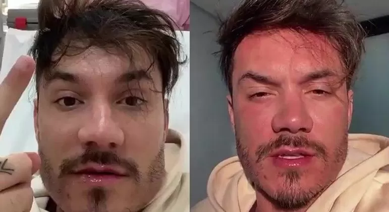 Ultimamente, notícias de famosos que se mostram arrependidos da harmonização facial têm aparecido com frequência. O que isso diz sobre as tendências de procedimentos estéticos?