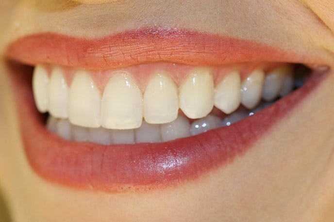 Odontologia estética