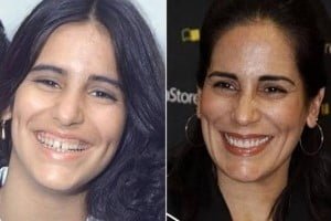 tendências da odontologia estética