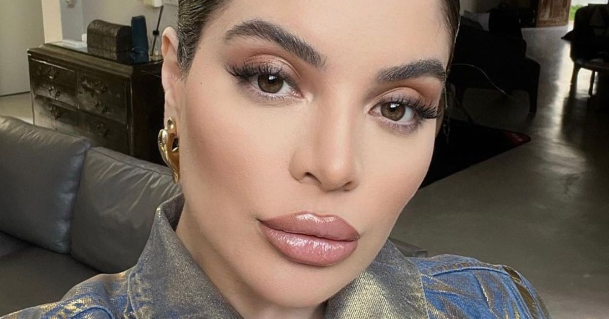 Famosos que se dizem arrependidos por terem realizado procedimentos estéticos faciais estão pipocado com frequência em diferentes mídias.