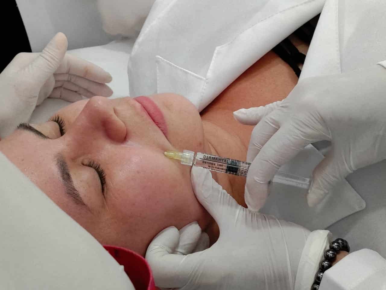 Botox ou Preenchimento Facial? Qual será que é a melhor opção? Quando o objetivo é rejuvenescimento, as duas especialidades, tanto o botox quanto o preenchimento com ácido hialurônico são eficazes para tratar as rugas, porém de formas diferentes.