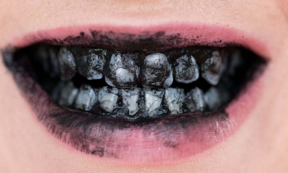 Uso do carvão ativado virou febre no Brasil, mas será que realmente faz efeito?Acompanhando a demanda e o crescimento do mercado estético, novos produtos aparecem com a promessa de soluções efetivas e de baixo custo para problemas complexos, como é...