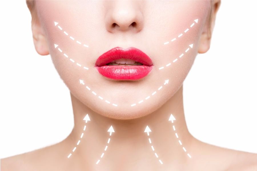 A odontologia estética continua inovando e os fios de sustentação é mais uma aposta do setor, unindo beleza facial e sorriso perfeito.