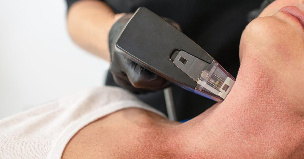 O tratamento chamado de Morpheus tem sido um dos procedimentos estéticos mais comentados dos últimos tempos.