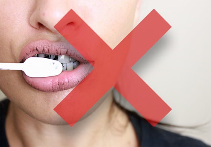 Atenção para os cuidados em relação a fórmulas caseiras que prometem substituir os tratamentos estéticos dentários.