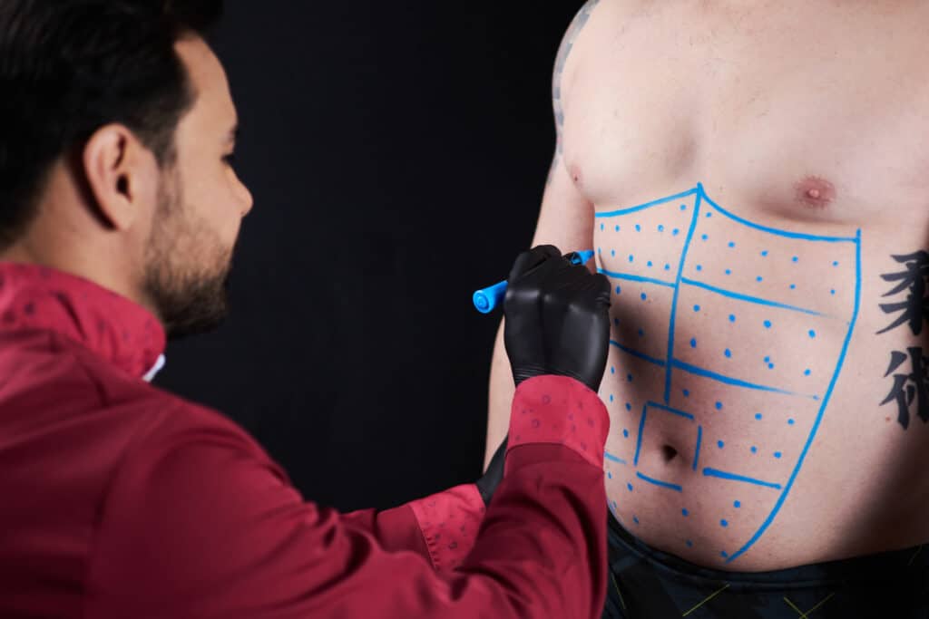 O processo de entrar em forma é diferente para cada corpo e objetivo do paciente.