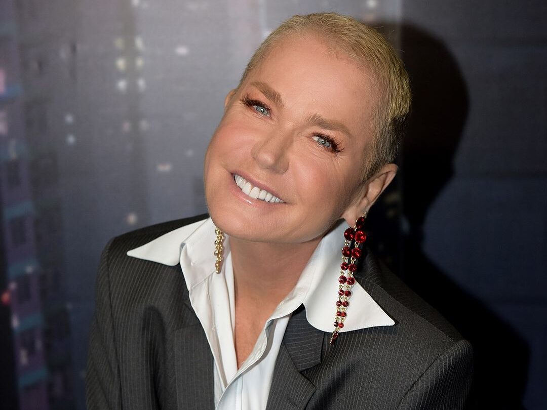 A apresentadora Xuxa Meneghel surpreendeu a internet esta semana com o volume de procedimentos que realizou de uma vez, foram 80 intervenções em 7 horas.