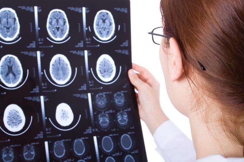 Neurological Injuries Following a Car Accident