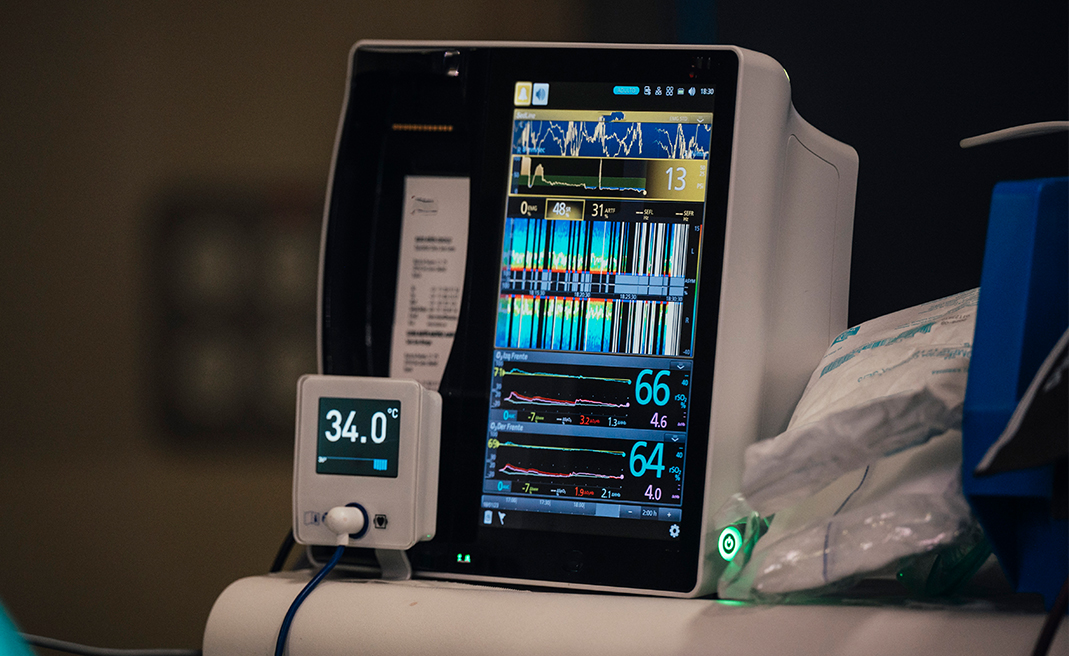 Medical device screen showing patient vital signs and a smaller device displaying 34.0°C temperature.