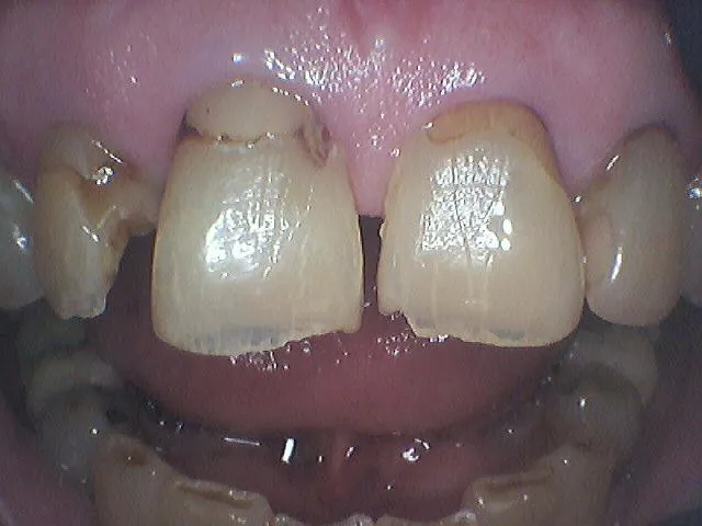 Before Image