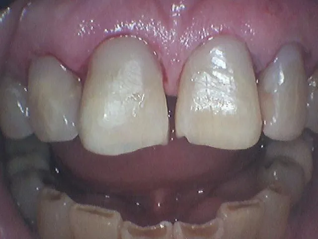 After Image