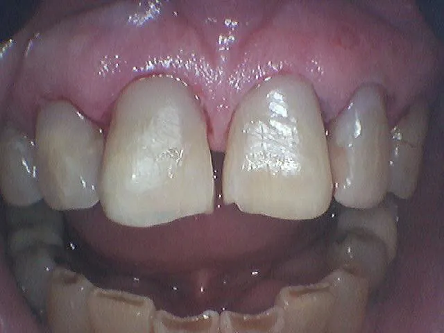 After Image