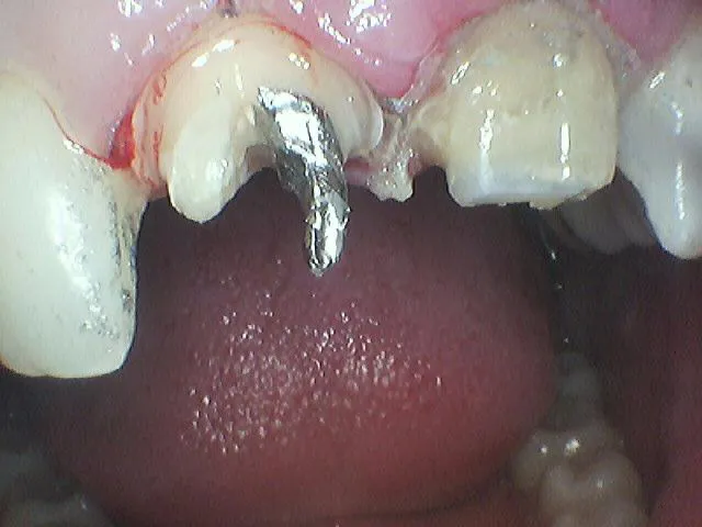 Before Image