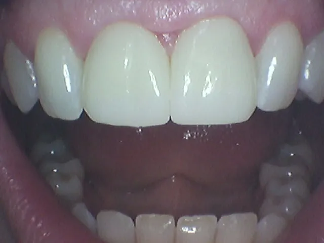 After Image