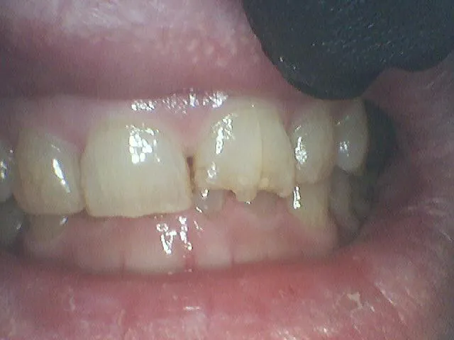 Before Image
