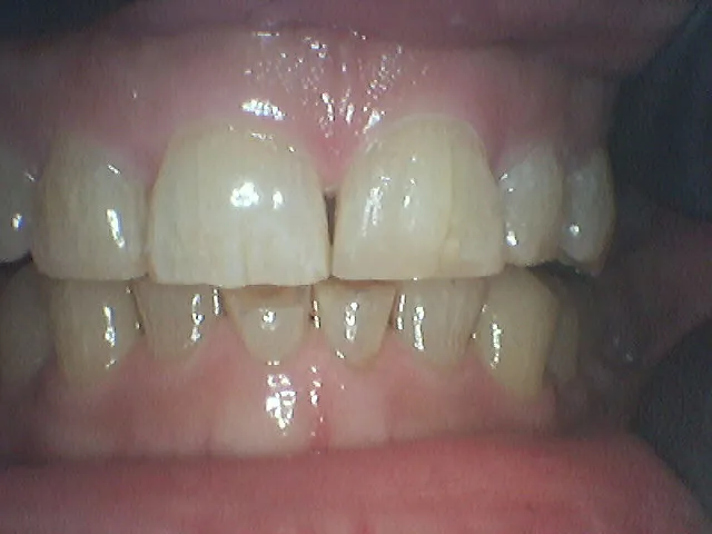 After Image