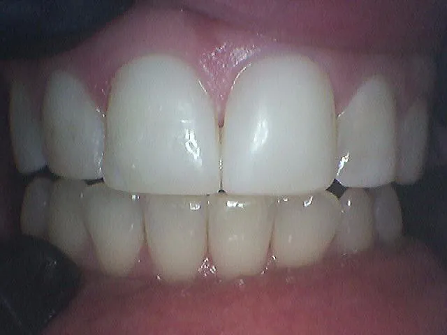 After Image