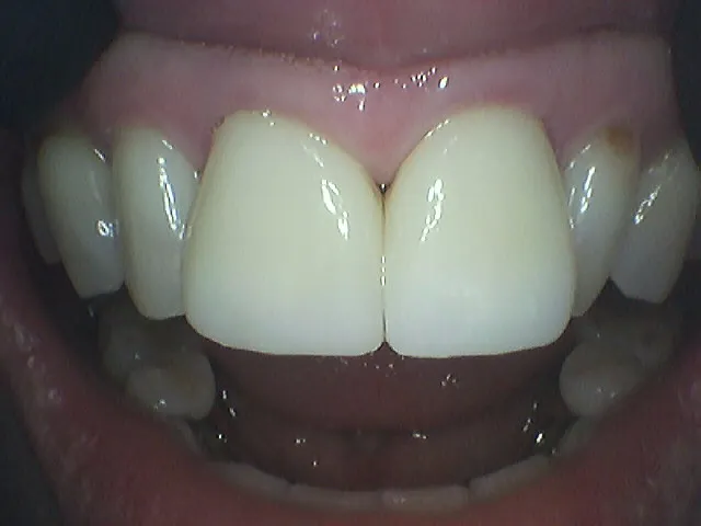 After Image