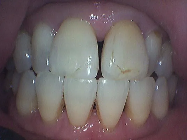 Before Image
